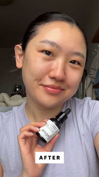 Sarah Han after applying the CNP Derma Answer Active Boost 11 Ampule